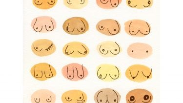 不同类型乳房的图示