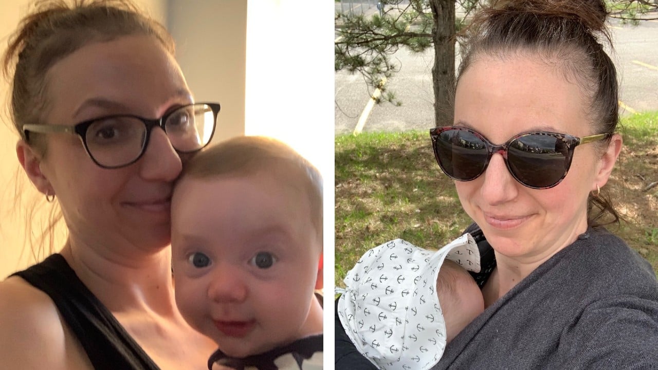 右图是作者戴着墨镜抱着婴儿的照片，照片中她的发际线逐渐后退。在左边，作者带着眼镜抱着她的孩子。都显示她在怀孕后脱发。